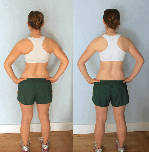 before and after 3 month back
