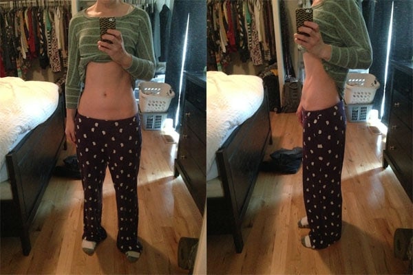 stomach