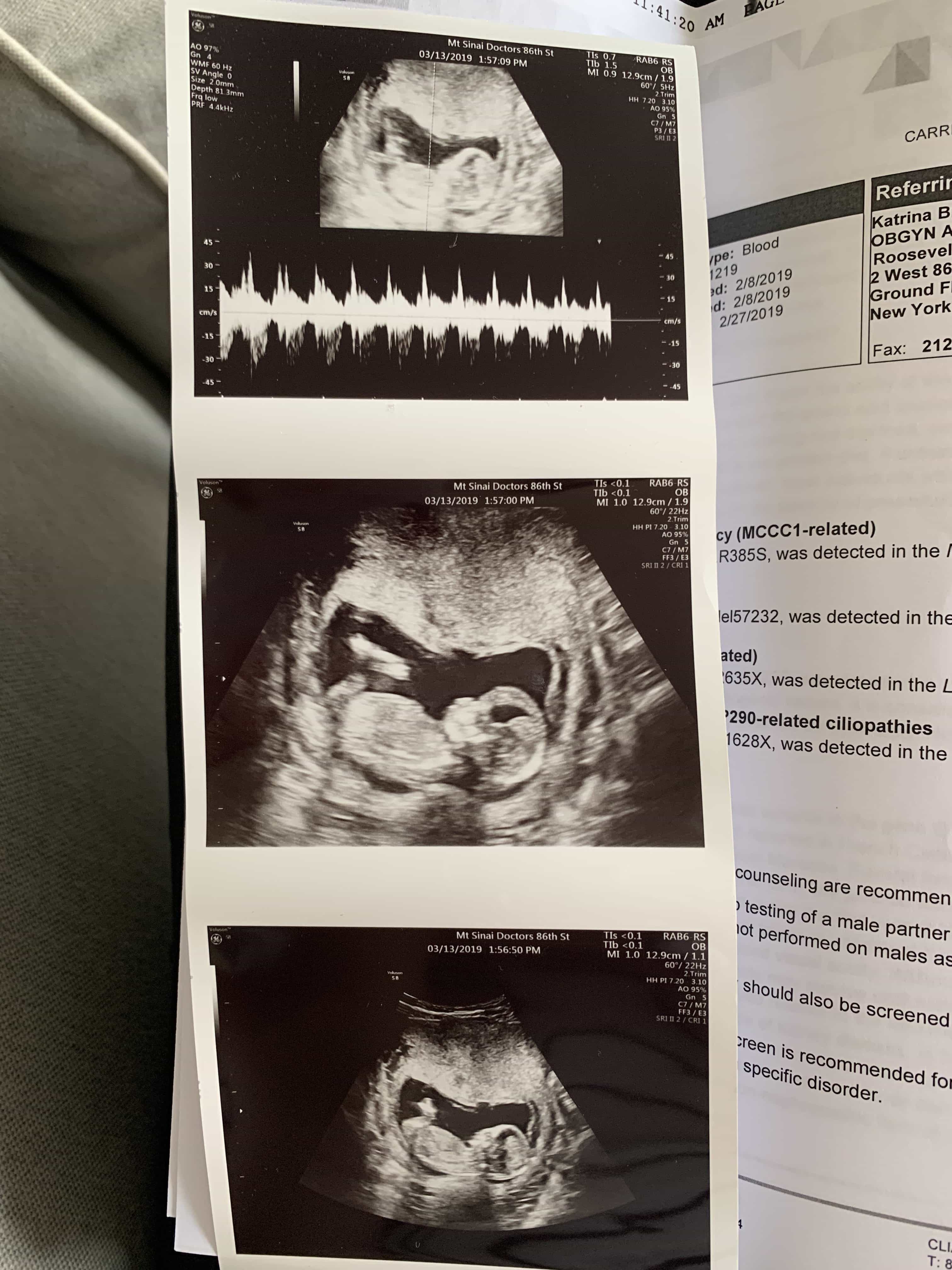 Porter ultrasounds