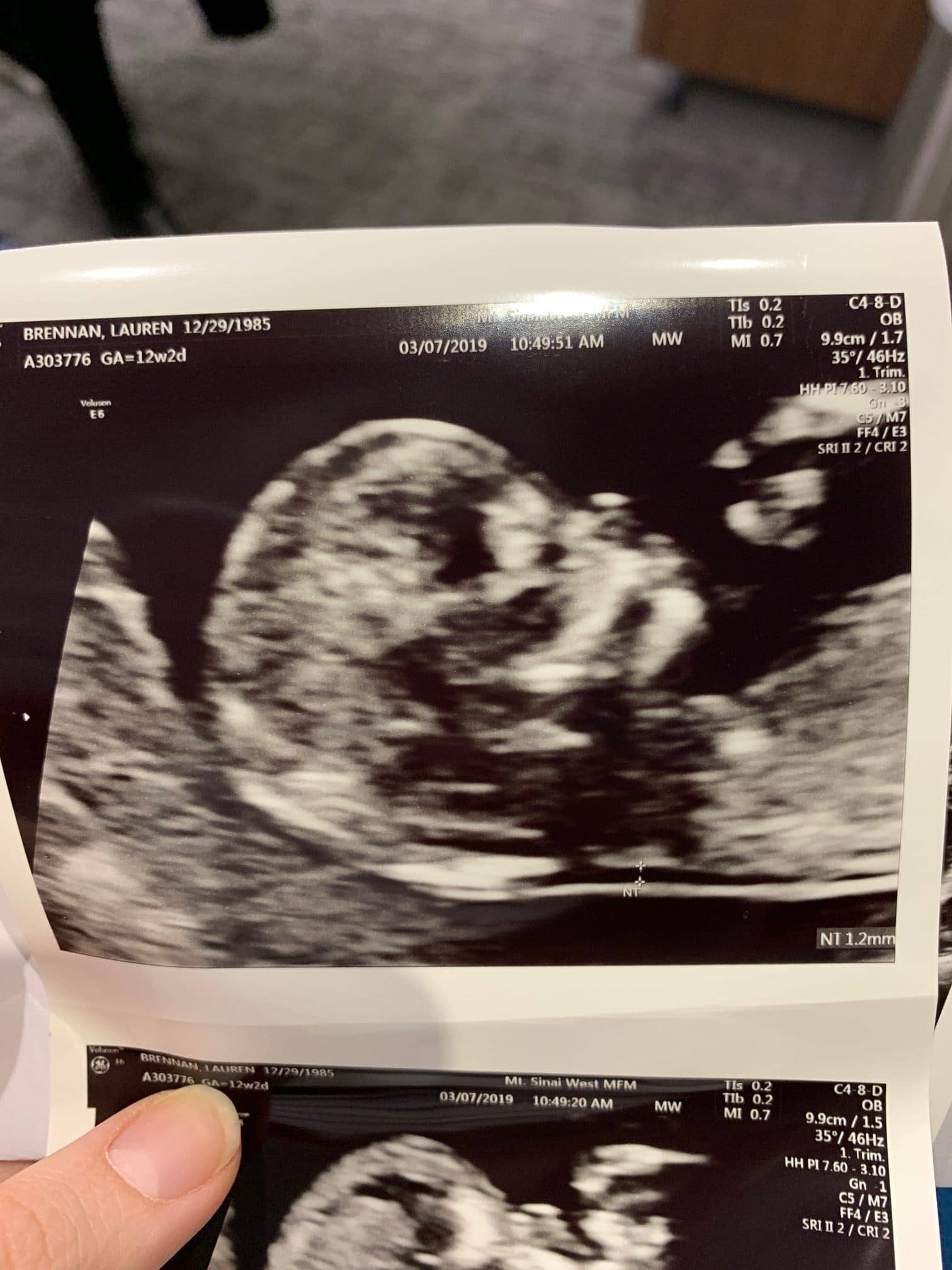 Ultrasound picture